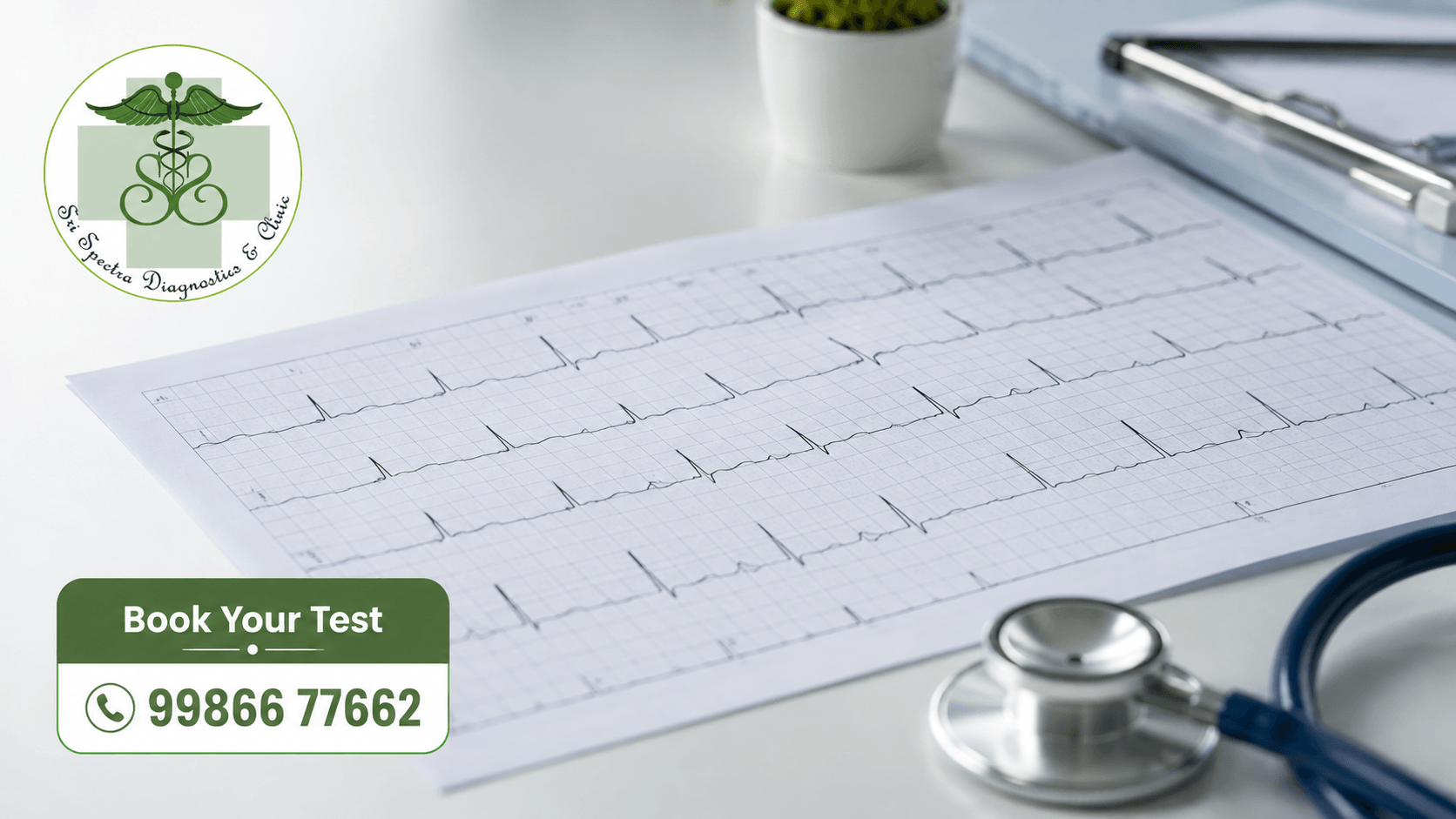 ECG waveform printout showing heart rhythm at Sri Spectra Diagnostics and Clinic
